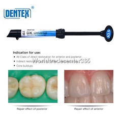 Dental Dentex Universal /Flowable Medium Flow Light Cure Composite Resin Refill