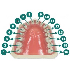 Ivorine Teeth Typodont 860 – Cavity Prep 5 PACK Compatible w/ Columbia 860 Brand