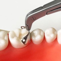 Dental Sectional Matrix Bands 4.5 5.5 6.5 Niti Retaining Rings Wedges Palodent