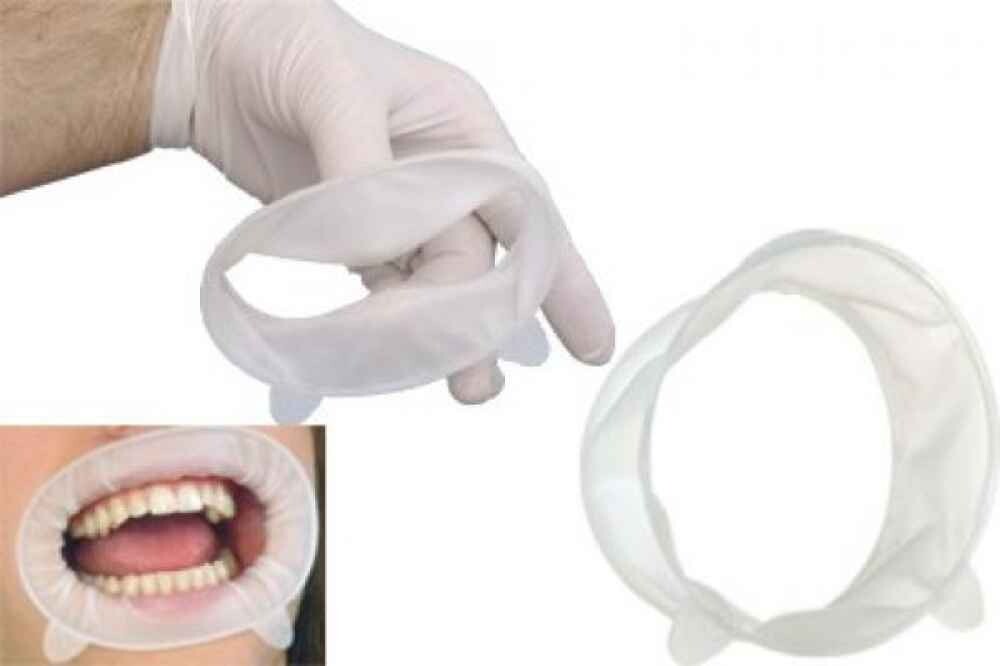 `10 x Ivoclar OPTRAGATE 3D Mouth Opener Cheek & Lip Retractor Small/Regular