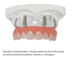 All-On-4 Dental Implant System Overdenture Treatment Teeth Model U/L Jaw W/screw