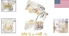 Educational Implant Typodont Model for Role Play – Perfect for Dental Schools