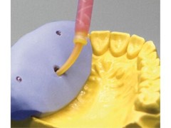 Vincismile Non Reversible Automix Flexible A-Silicone-Based for Gingival Masks