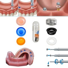 Locator Abutment Replacement Male Retention Inserts Cap Overdenture Inserts PEEK