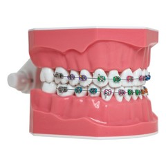 US Dental Orthodontic Typodont 1:1 Teeth Model with Brackets Braces M7010-2 New