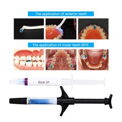 Dental Light Cure Orthodontic Adhesive Kit Blue Open bite and ortho band bonding