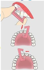 Easyinsmile IPR Orthodontics Stripping Dental Kit Interproximal Reduction Strips