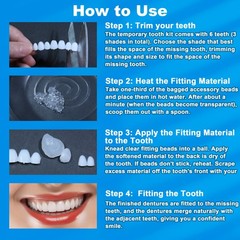Veneers Teeth for Women, Tooth Replacement Missing Teeth, Upper Veneer 6PCS