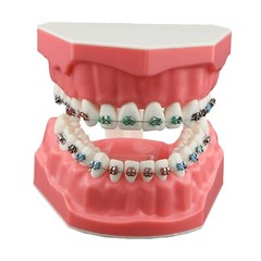 US Dental 1:1 TypodontTeeth Model Orthodontic with Metal Brackets Brace M7010-2