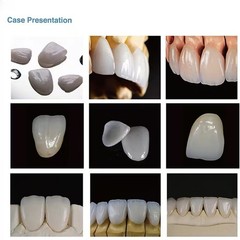 US C14 Emax Dental Glass Ceramic LT Lithium Dislicate CAD/CAM Cerec Blocks 5PCS