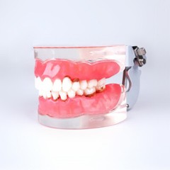Dental Adult Pathological Periodontal Disease 4017# Dental Typodont Teeth Model