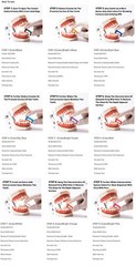 Easyinsmile IPR Orthodontics Stripping Dental Kit Interproximal Reduction Strips