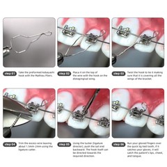 Dental Orthodontic SS Wires Kobayashi Preformed Ligature Ties Long/Short/Twist