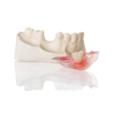 DSTVITOflexi – Flexi Thermoplastic Dentures Material