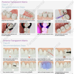 Dental Transparent Matrix Clear Bow Matrice Band Anterior Front Bioclear TorVM