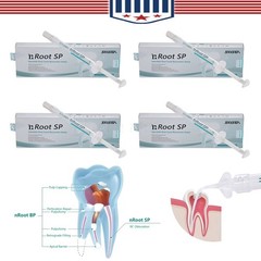 1g SP Dental Injectable Root Canal Bioceramic Sealer Endodontic Sealing Filling
