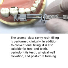 Dental Universal Matrix Band Tofflemire Stainless Steel Matrice 0.04mm Thickness