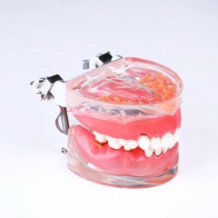 Dental Adult Pathological Periodontal Disease 4017# Dental Typodont Teeth Model
