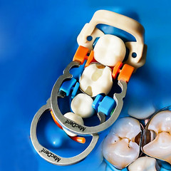 Dental Matrix Bands Ring Sectional Matrice Clamp Fit Garrison Palodent V3 System