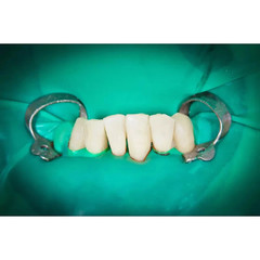 10Pcs #13A Ivory Molar Rubber Dam Clamps Surgical Dental Isolation KitTool Steel