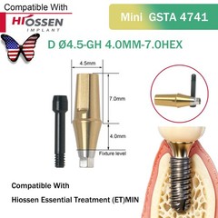 US Dental Straight Abutment Hiossen ET Osstem TS Ti Mini Regular Platform Hex