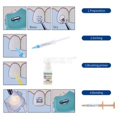 Dental Orthodontic No-Mix Direct Bonding System Adhesive Primer Resin