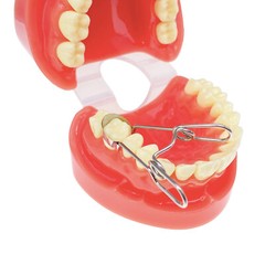 20Pcs/Pack Dental Saddle Contoured Metal Matrices Matrix Band / Springclip