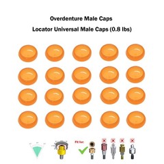 Dental Overdenture Locator Implant Abutment Retention Caps Male Cap Inserts Set