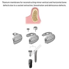 3X Dental GBR Titanium Mesh Membrane Guided Bon Regeneration Plate Flexible USA