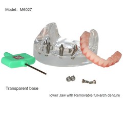 All-On-4 Dental Implant System Overdenture Treatment Teeth Model U/L Jaw W/screw