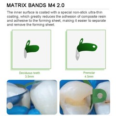 Dental Non-Stick Matrix Bands with PTFE Coat Sectional Contoured Metal Matrices