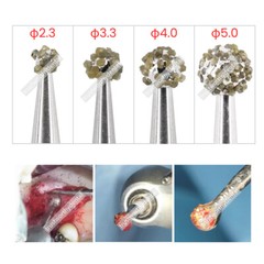 Dental Degranulation Burs Kit Osseous Debridement Soft Tissue Removal Diamond US