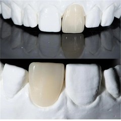 US Dental Lithium Disilicate Glass Ceramic Blocks CEREC Veneer Crown C14 CAD/CAM