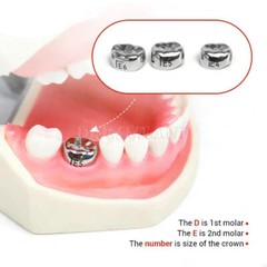 48pcs Dental Kids Adult Crown Stainless Steel Primary Molar Crowns Pediatric