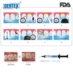 DENTEX DX.FLOW Dental Flowable Medium Flow Light Cure Composite A2 Resin