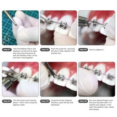 AZDENT Dental Ortho Wire Preformed/Kobayashi Ligature Wire Ties Long/Short Twist