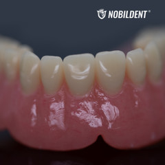 1000g Dental HEAT CURRING Acrylic Denture Base Material Heat Cure Powder