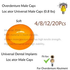 Dental Overdenture Locator Implant Abutment Retention Caps Male Cap Inserts Set