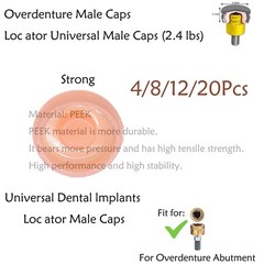 Dental Overdenture Locator Implant Abutment Retention Caps Male Cap Inserts Set