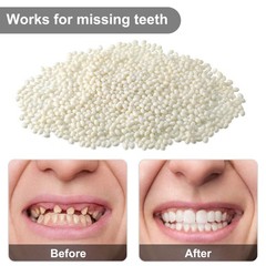 Nuanchu 100g Tooth Repair Kit Moldable Beads 3.52 Ounce (Pack of 1), White