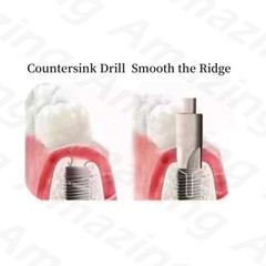 4.5MM Dental Countersink Drill Profiler Remover Smooth Ridge Trimmer Drills