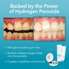 Periodontal Treatment for Teeth Promotes Healthy Gums Care Gel 3 fl oz New
