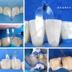 Dental Transparent Matrix Clear Bow Matrice Band Anterior Front Bioclear TorVM