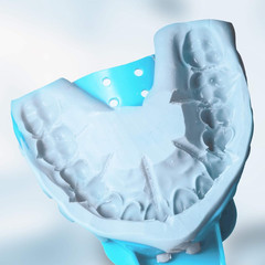 Dental Impression Tray Bag of 12, Perforated Disposable Trays,10 Anterior L