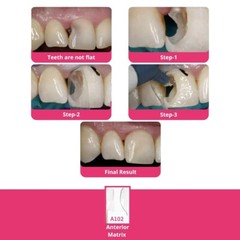 BioClear Anterior Kit Modern Matrix System for Esthetic Restorations Fast Ship