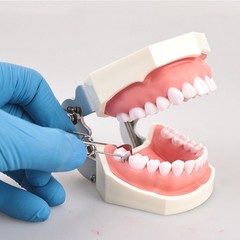 Dental Sectional Contoured Matrices No.1.330, 35μm Hard, with Spring Clip 36pcs