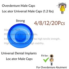 Dental Overdenture Locator Implant Abutment Retention Caps Male Cap Inserts Set