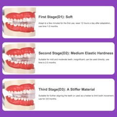 3-Stage Adult Teeth Aligners Orthodontic Braces Trainer for Dental Alignment Hot
