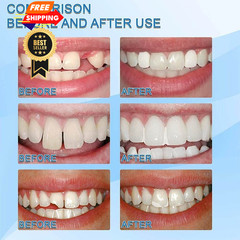 Tooth Repair Kits,2Pcs 30ml Dental Denture 2pcs