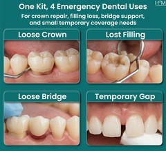 Zinc Oxide Eugenol Dental Cement Kit – Instant Tooth Repair, Crown & Bridge Fill